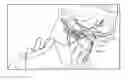 Fig. 01 - Method of stimulating a hypoglossal nerve for controlling the position of a patients tongue