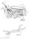 Fig. 03 - Method of stimulating a hypoglossal nerve for controlling the position of a patients tongue