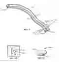 Fig. 04 - Method of stimulating a hypoglossal nerve for controlling the position of a patients tongue