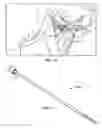 Fig. 07 - Method of stimulating a hypoglossal nerve for controlling the position of a patients tongue