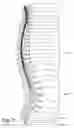 Fig. 03 - Systems and methods for treating autonomic instability and medical conditions associated therewith