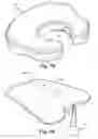Fig. 08 - Systems and methods for treating autonomic instability and medical conditions associated therewith