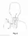 Fig. 09 - Systems and methods for treating autonomic instability and medical conditions associated therewith