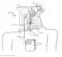 Fig. 01 - Transvascular nerve stimulation apparatus and methods