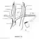 Fig. 16 - Transvascular nerve stimulation apparatus and methods