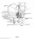 Fig. 04 - Antenna and methods of use for an implantable nerve stimulator