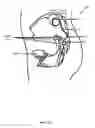 Fig. 06 - Antenna and methods of use for an implantable nerve stimulator