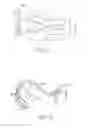 Fig. 02 - Method for discriminating between ventricular and supraventricular arrhythmias