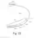 Fig. 32 - Method for discriminating between ventricular and supraventricular arrhythmias