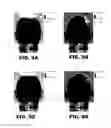 Fig. 05 - Deep transcranial magnetic stimulation apparatus and method