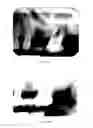 Fig. 08 - Laser assisted wound healing protocol and system