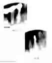 Fig. 09 - Laser assisted wound healing protocol and system