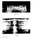 Fig. 10 - Laser assisted wound healing protocol and system