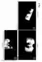 Fig. 09 - Methods and systems for brachytherapy planning based on imaging data