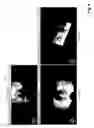 Fig. 11 - Methods and systems for brachytherapy planning based on imaging data