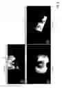 Fig. 12 - Methods and systems for brachytherapy planning based on imaging data