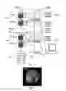 Fig. 04 - Assembly, apparatus, system and method