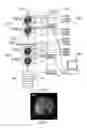 Fig. 04 - Assembly, apparatus, system and method