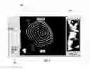 Fig. 05 - Systems and methods for imaging and ablating tissue