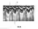 Fig. 09 - Systems and methods for imaging and ablating tissue