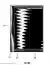 Fig. 10 - Systems and methods for imaging and ablating tissue