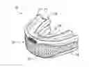 Fig. 01 - MOUTHGUARD