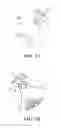 Fig. 03 - Climbing aid comprising a climbing skin and a tip and tail for use therein