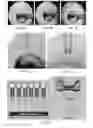 Fig. 08 - Systems and methods of preparing stabilized lipid assemblies