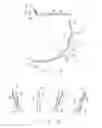 Fig. 03 - Paintless dent removal tool
