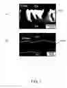 Fig. 08 - Forming a solder joint between metal layers