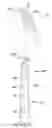 Fig. 01 - Overmolded disposable cutlery articles