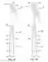 Fig. 02 - Overmolded disposable cutlery articles