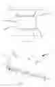 Fig. 03 - Three-dimensional printing excess deposited particulate handling