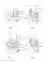 Fig. 04 - Pressure unit and end fitting having a pressure unit of this type