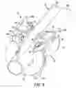 Fig. 09 - Zip line assembly and trolley therefore
