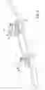 Fig. 04 - Active front deflector