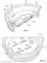 Fig. 15 - Closure and lid and method of forming closure and lid