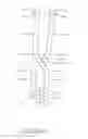 Fig. 05 - Compressive barred brackets