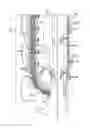 Fig. 01 - Rope hoisting system