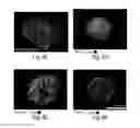 Fig. 12 - Methods and compositions for increased safety of stem cell-derived populations