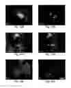 Fig. 16 - Methods and compositions for increased safety of stem cell-derived populations