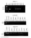 Fig. 07 - Methods for producing enucleated erythroid cells derived from pluripotent stem cells