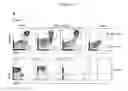 Fig. 25 - Human progenitor T-cells into NK cells