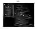 Fig. 15 - METHODS OF CELLULAR REPROGRAMMING