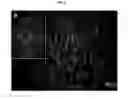 Fig. 16 - METHODS OF CELLULAR REPROGRAMMING