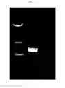 Fig. 03 - sp. KMF001 having high cellulase activity