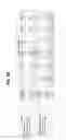 Fig. 14 - Isolation and detection of DNA from plasma