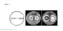 Fig. 02 - Dereplication strain of 