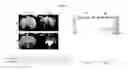 Fig. 09 - Construction of new cucumber fruit mottle mosaic virus derived subgenomic promotor and expression vector, and use thereof