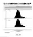 Fig. 07 - TRANSPOSABLE ELEMENTS, TDP-43, AND NEURODEGENERATIVE DISORDERS